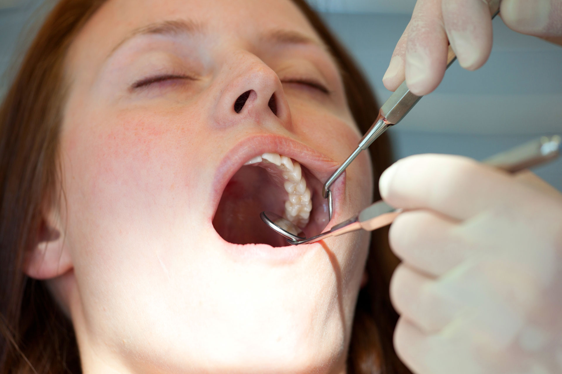 prima visita cavo orale dental extra 1